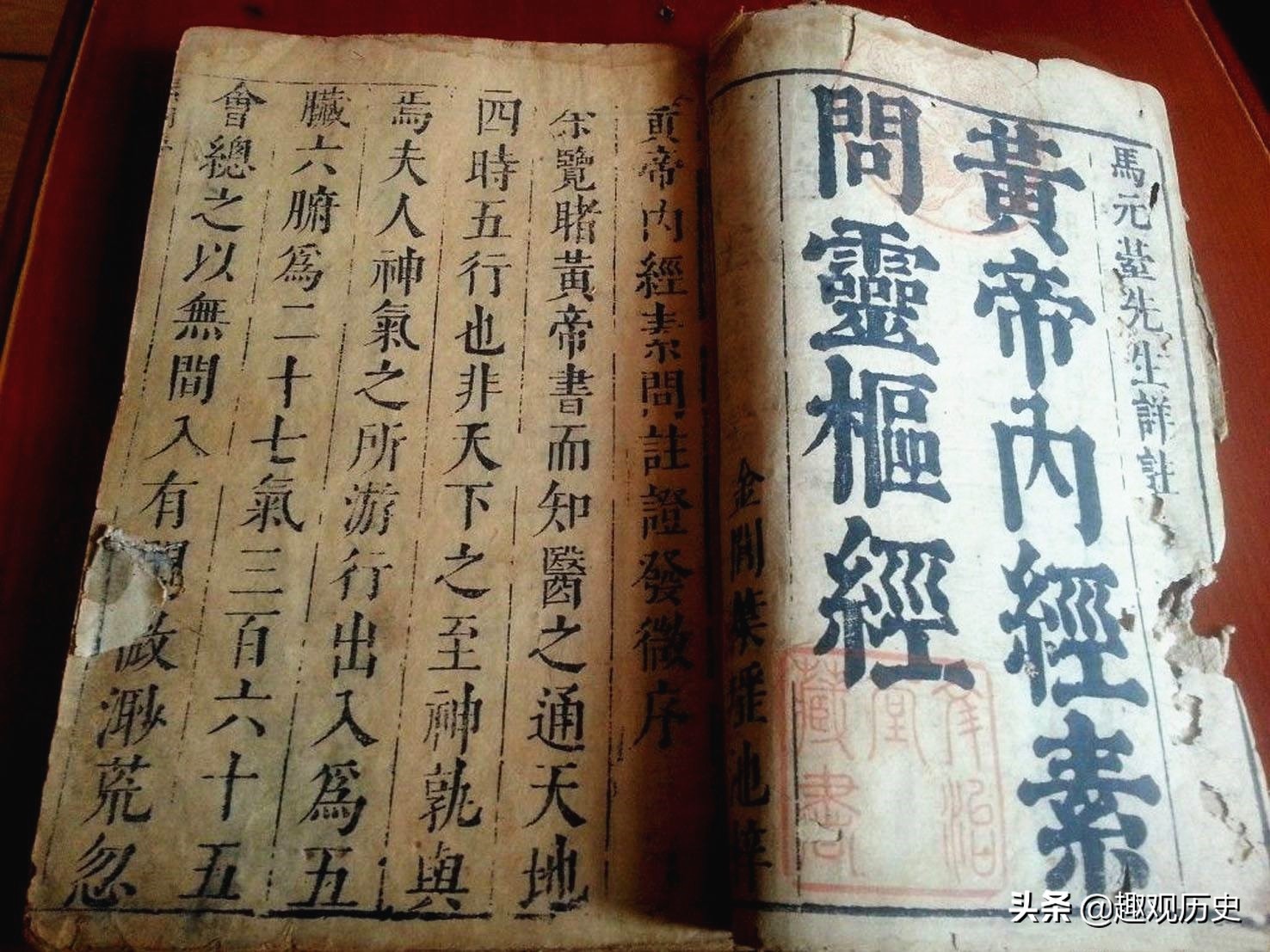 作为我国古代四大医典之首,《黄帝内经》奠定了我国中医学的基础,可以