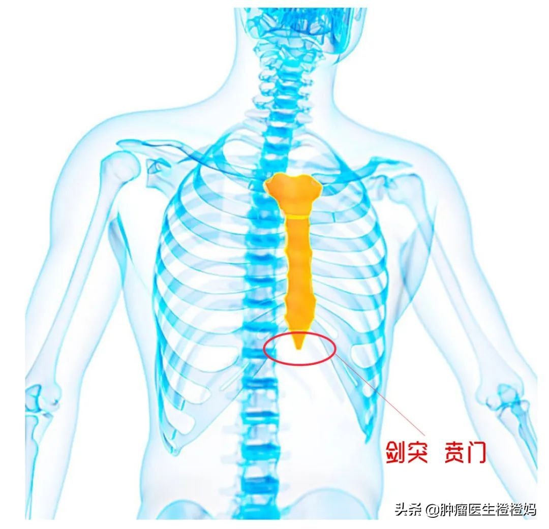 腹痛腹胀食欲差，检查发现竟是癌症晚期，医生：这样做可早诊早治