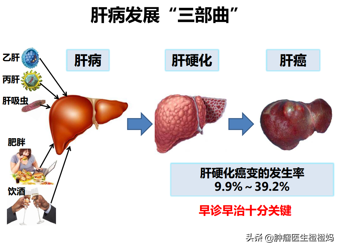 腹痛腹胀食欲差，检查发现竟是癌症晚期，医生：这样做可早诊早治