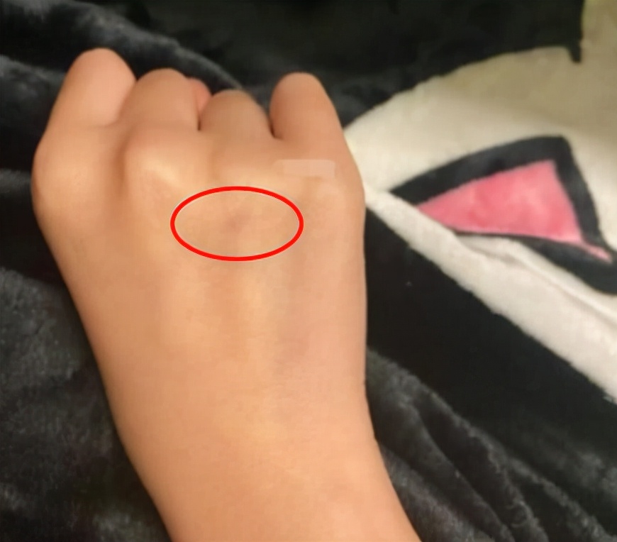 兩網(wǎng)友自稱在廣州街頭被人扎針(圖1)