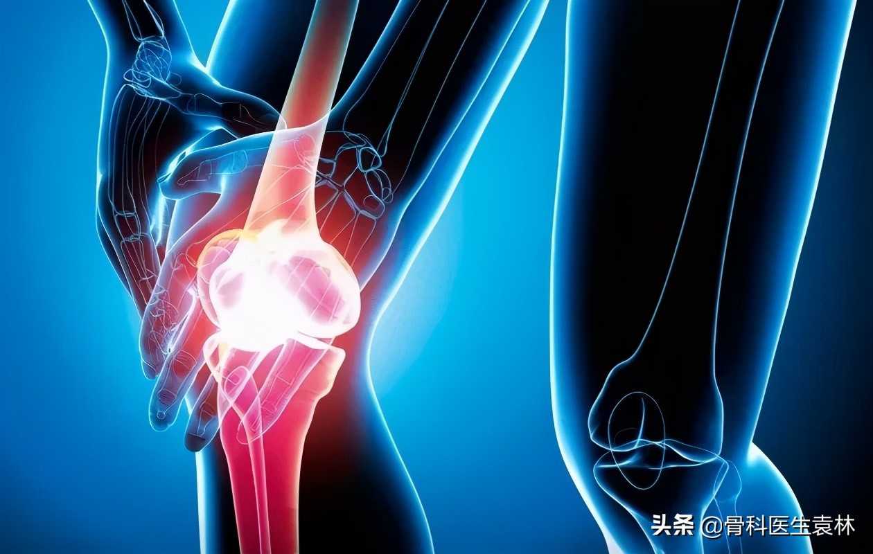 髌骨软化症的科学治疗方法与康复建议