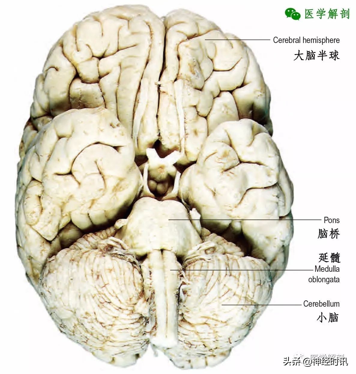 中枢神经系统 | 脑