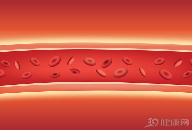 血管硬化，调理得“软”着来：用对4个方法，对血管更安全