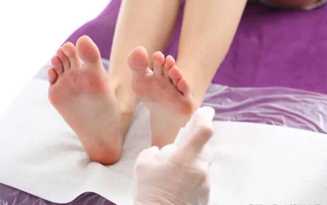 医生教你怎么治理香港脚（脚气、足癣）