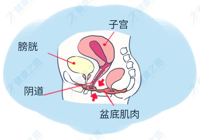 “生完娃，下面松了还憋不住尿”…1个动作教你紧回来