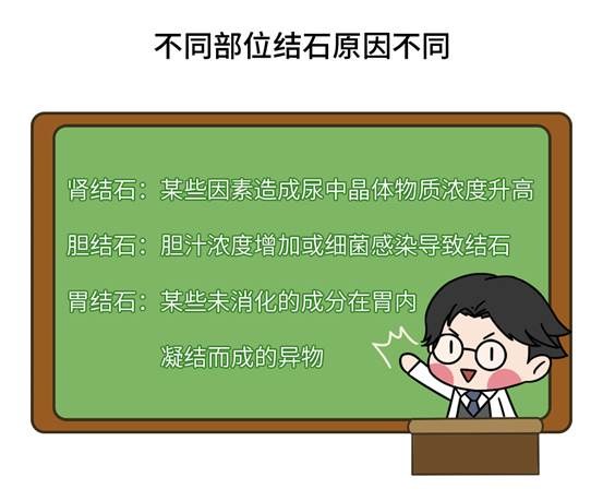 很多结石都是“吃”出来的！这些不良饮食习惯，你中招了吗？