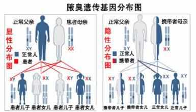 狐臭是生理现象还是病，怎么解决？这篇有味道的文章，告诉你答案