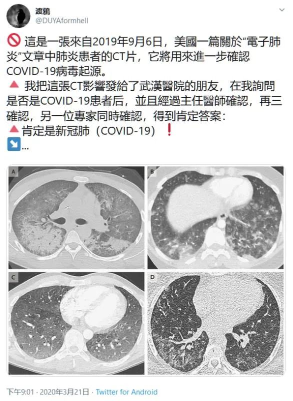 美国研发新冠病毒并投毒中国，不仅是合理推测，也是铁证如山