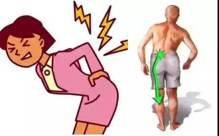 腰痛腿麻怎么办？是椎间盘突出了吗？