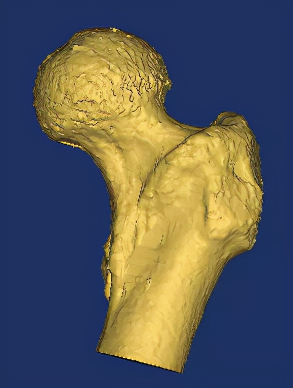 有一些医疗工业者使用它做ct三维建模,利用医疗设备采集影像,导入软件