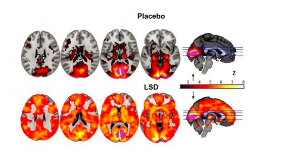 零零后贩卖“邮票”毒品LSD？它曾让乔布斯沉迷其中