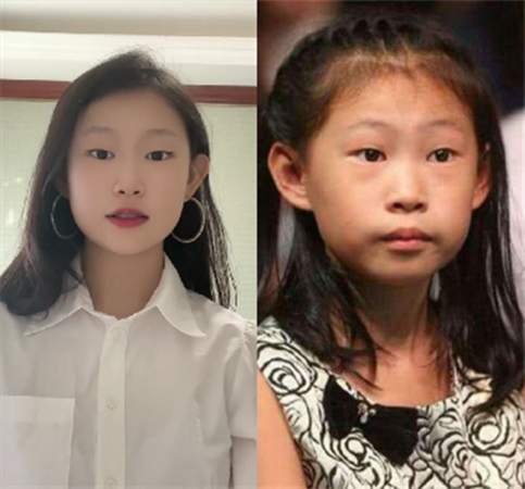 女大十八变！这些基因优秀的星二代，不靠整容照样越长越好看