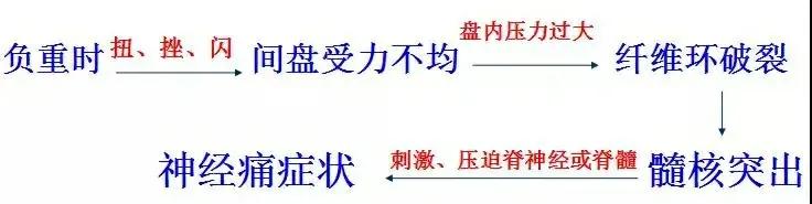 腰痛腿麻怎么办？是椎间盘突出了吗？