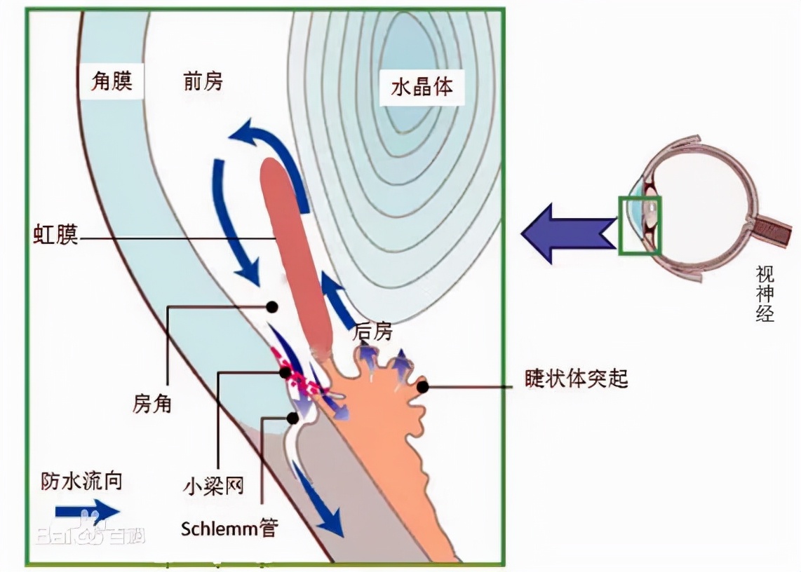 一种“红痛”眼病，不早治会瞎