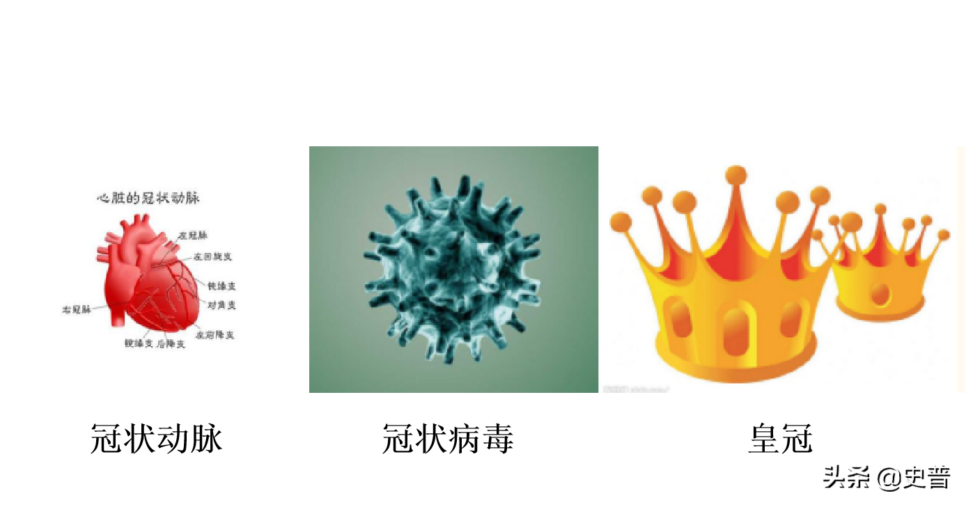 因其形状恰似一顶王冠而得名;冠状病毒是指这种病毒包膜上存在的棘