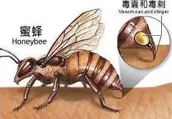 被蜂蜇伤，一个正确的处理能挽救一条生命！医生告诉你如何防治