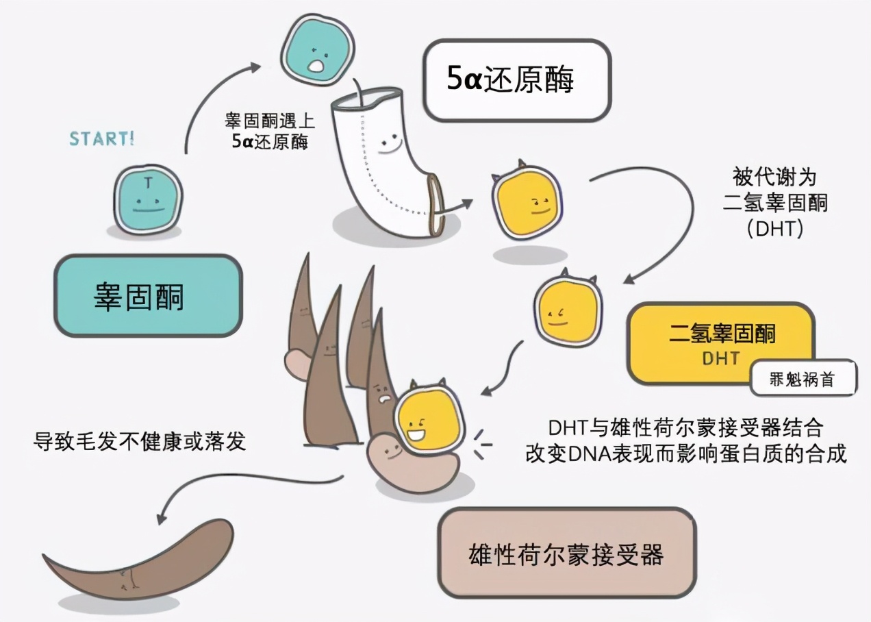 非那雄胺治疗雄激素性脱发，原理是什么？使用时应注意哪些事项？