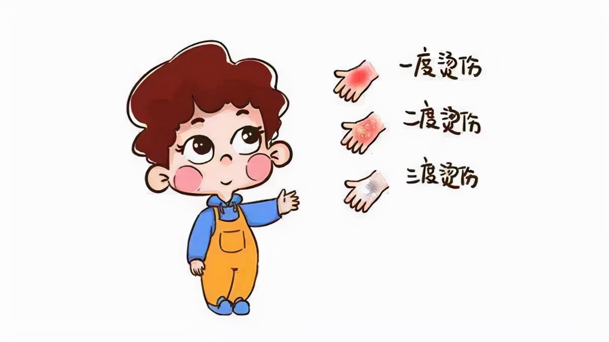 油烫伤（烧伤）后的正确处理方法