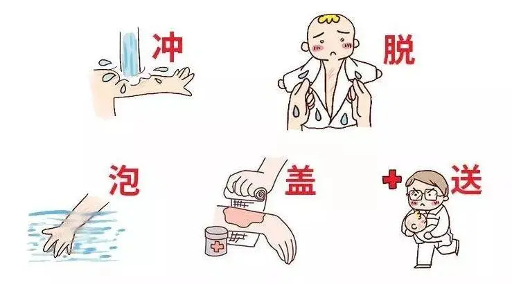 烧伤、烫伤后怎么办?五字诀帮你渡难关