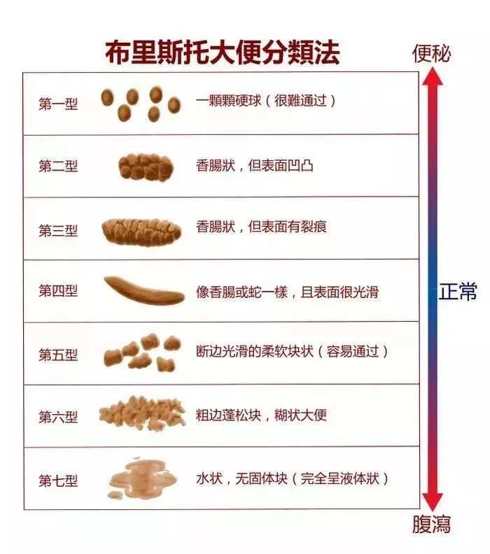 27岁小伙一天大便3次，确诊肠癌！3种大便异常是身体“警报”