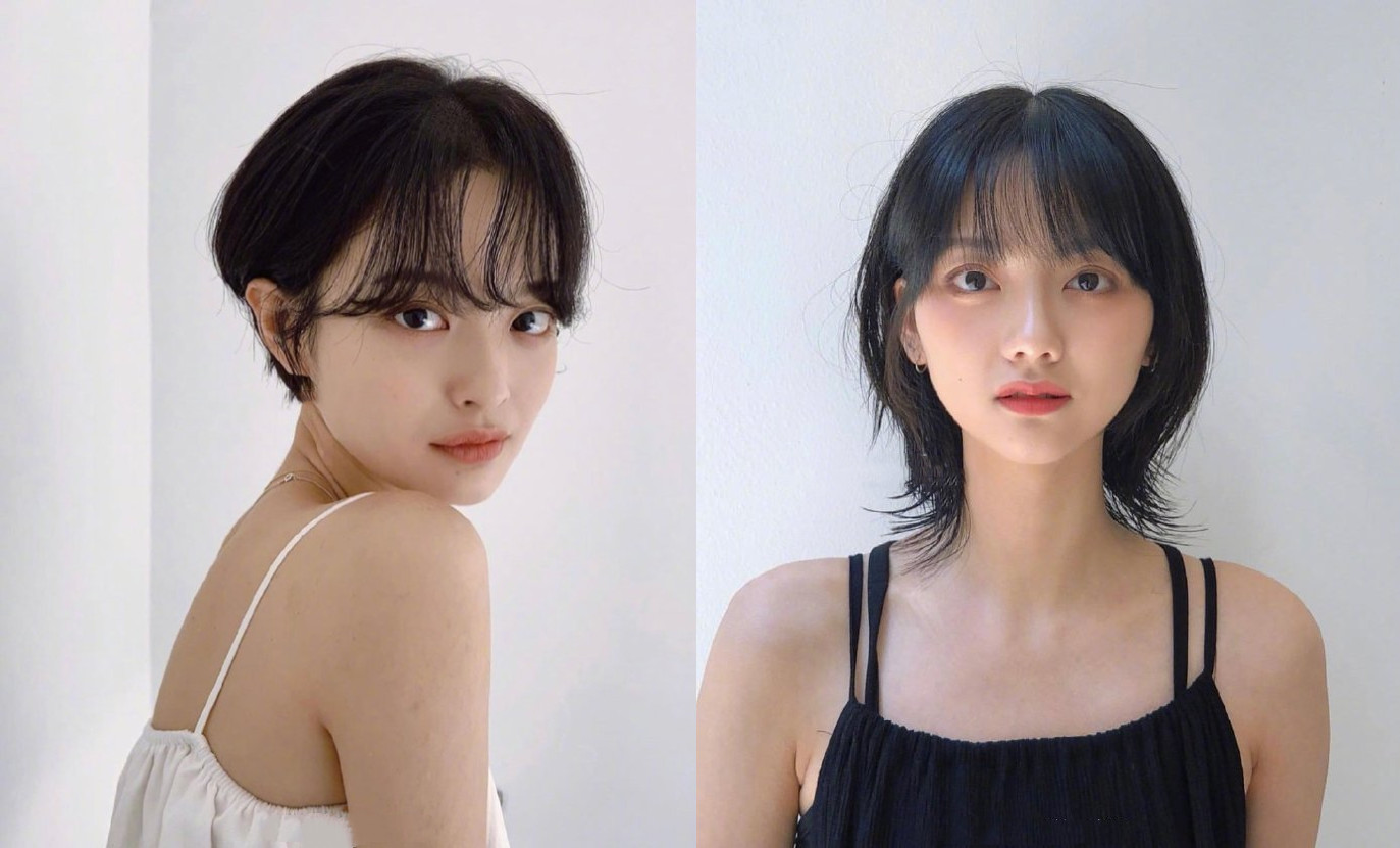 发际线过高怎么办？女生改善发际线问题的实用建议