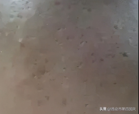 #健康中国行动2030#【变美秘籍】毛孔粗大怎么彻底解决？