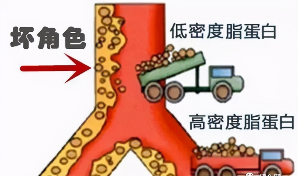 体检发现低密度胆固醇偏高，饮食上要注意什么呢？听听专家怎么说