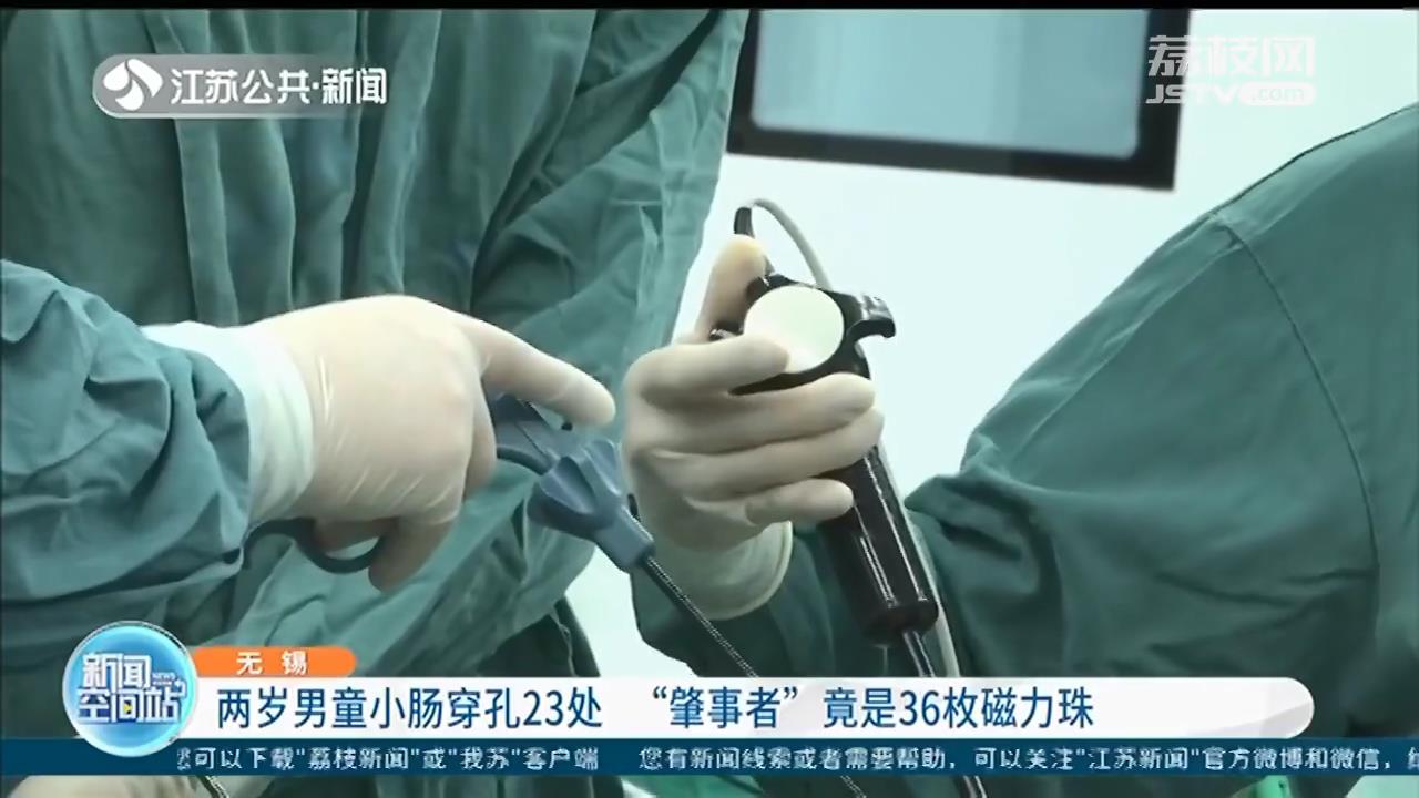 无锡两岁男童小肠穿孔23处，“肇事者”竟是36枚磁力珠