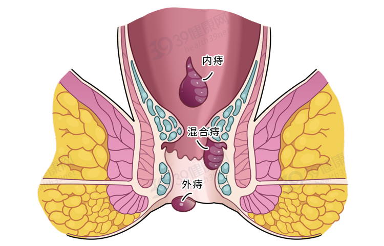保护肛门有多重要？每天清洗肛门可以预防疾病？到底怎么回事？