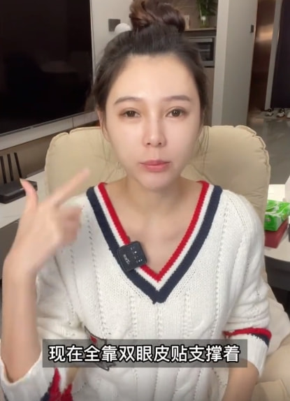 女網(wǎng)紅曬整容前后對(duì)比照，直言整容太多臉部松弛老10歲，后悔痛哭