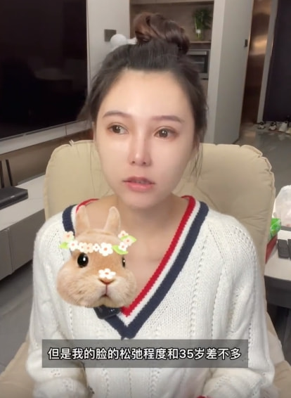 女網(wǎng)紅曬整容前后對比照，直言整容太多臉部松弛老10歲，后悔痛哭