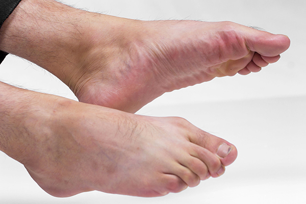 看起来不起眼的痣却有可能癌变？长在3个地方的痣，可能性高