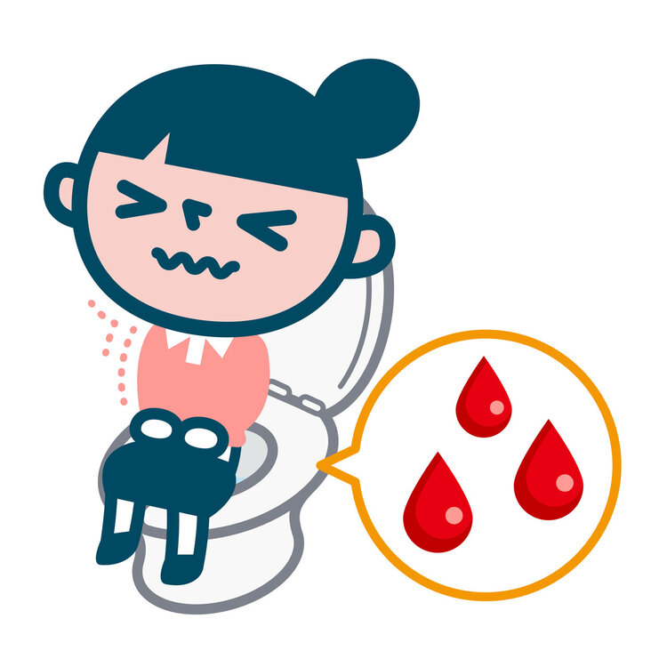 为什么需要清洗肛门？万万没想到，清洗肛门好处这么多