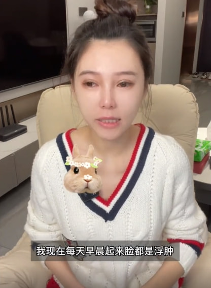 女網(wǎng)紅曬整容前后對比照，直言整容太多臉部松弛老10歲，后悔痛哭