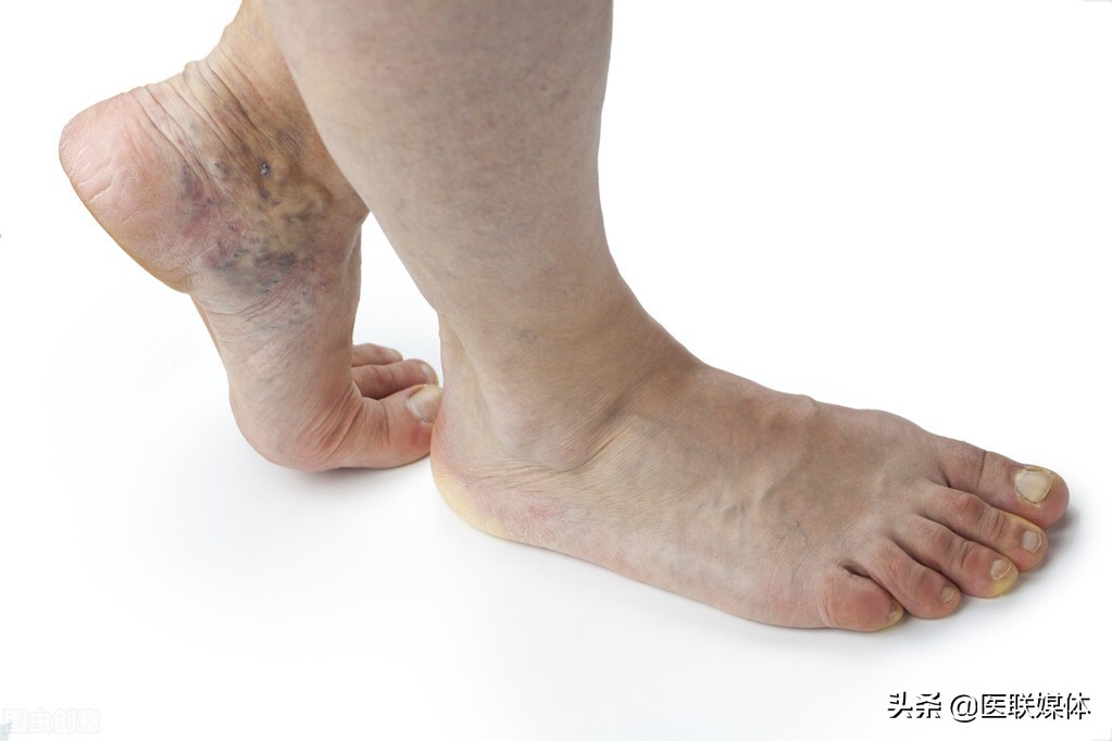 早上起床，身体不好的人可能会有这5种反常，别不当回事