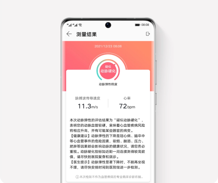 华为WATCH D正式发布：售价2988元！详细功能介绍了解一下