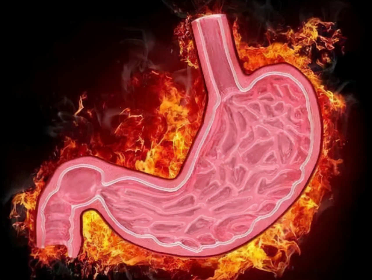 有胃火睡不香，有肝火易失眠，有心火爱做梦？这3招缓解“三火”