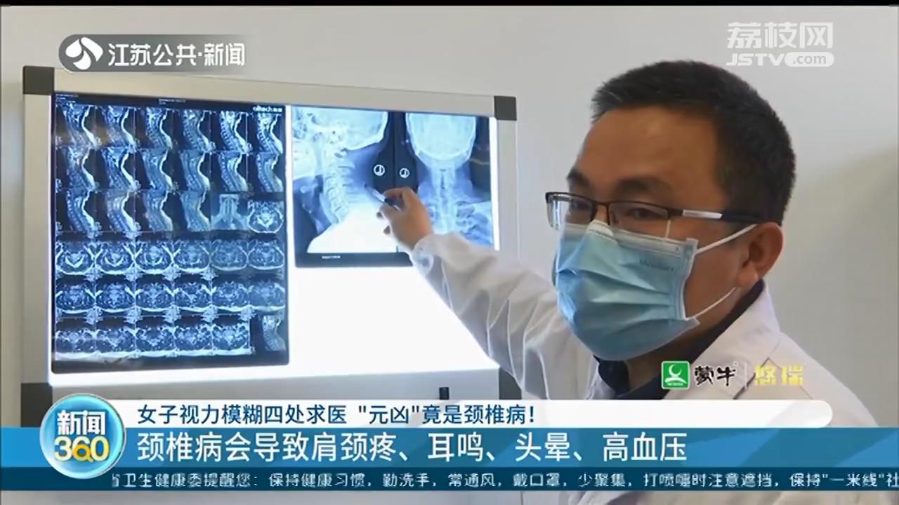 女白领视力模糊四处求医，“元凶”竟然是颈椎病