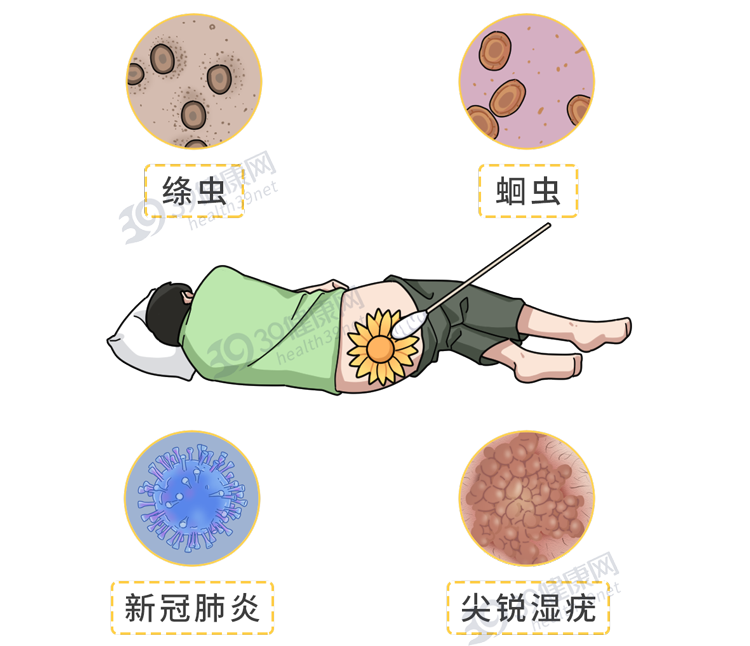 保护肛门有多重要？每天清洗肛门可以预防疾病？到底怎么回事？