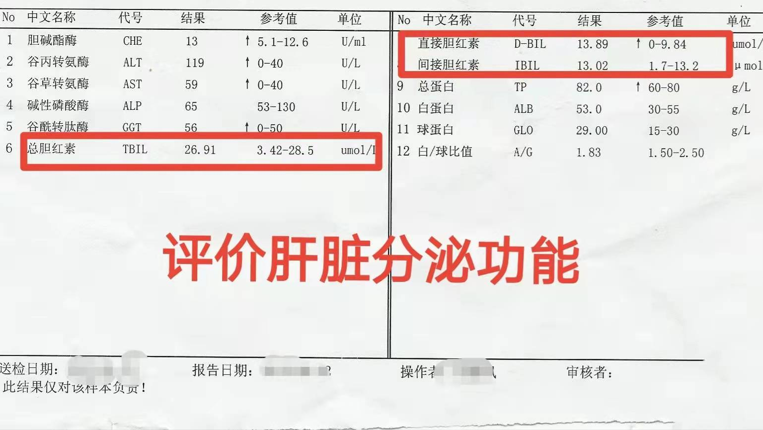 肝功能检查单怎么看？医生：这3个指标正常，说明你的肝脏很健康