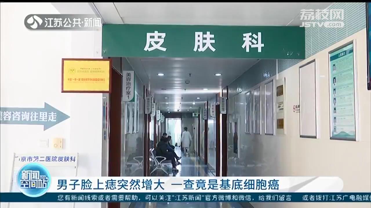 当心！男子脸上痣突然增大 一查竟是基底细胞癌
