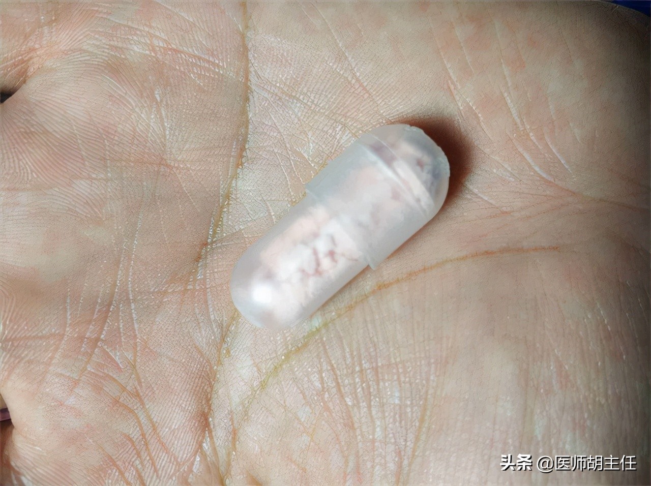 有一种痛，叫口腔溃疡！医生提醒：牢记这几招，促进口腔溃疡愈合