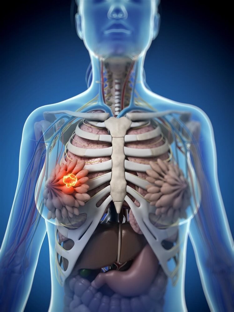 姚贝娜查出乳腺癌时是早期，经过化疗已经痊愈，为何人还是没了？