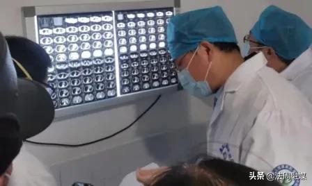 优质服务下基层——省胸科医院专家组来澧县结防所临床指导