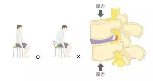 腰椎間盤突出就不能練瑜伽了嗎？