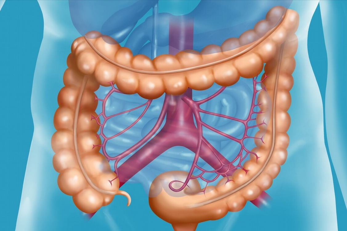 结肠是大肠还是小肠，发现结肠癌该怎么治？