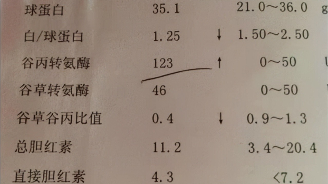 肝功能檢查單怎么看？醫生：這3個指標正常，說明你的肝臟很健康