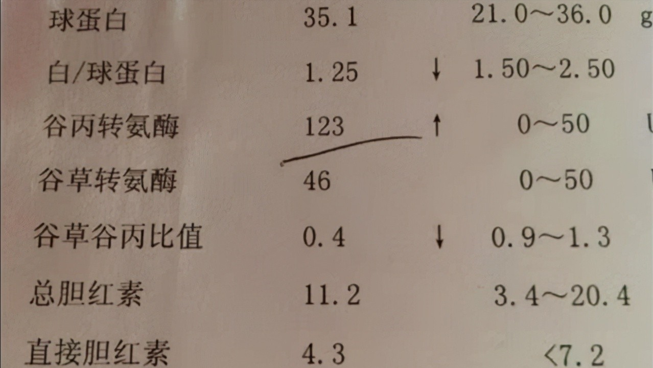 肝功能检查单怎么看？医生：这3个指标正常，说明你的肝脏很健康