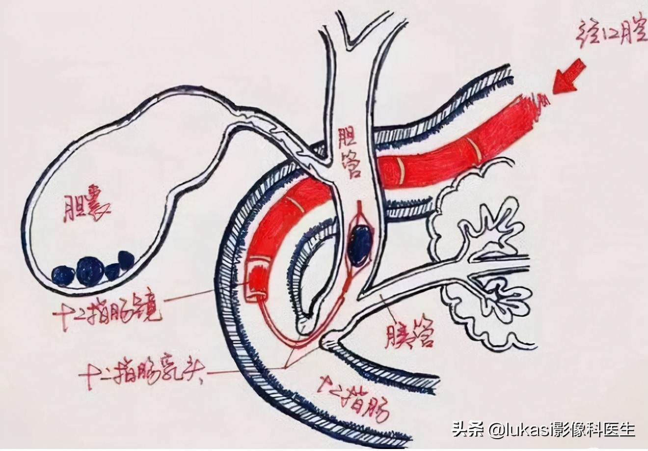 最难检测和治疗的