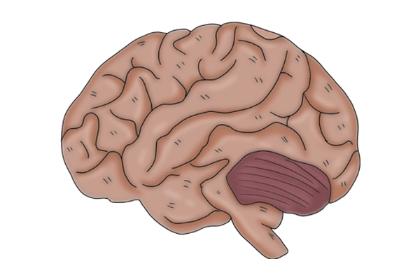 体检查出脑萎缩，是不是老年痴呆的信号？真正的信号是这4个